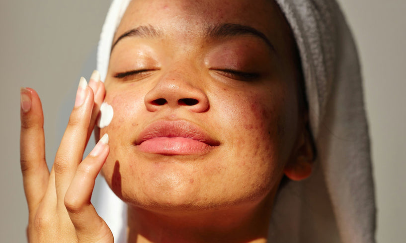 Retinal aftercare: Why sunscreen matters image
