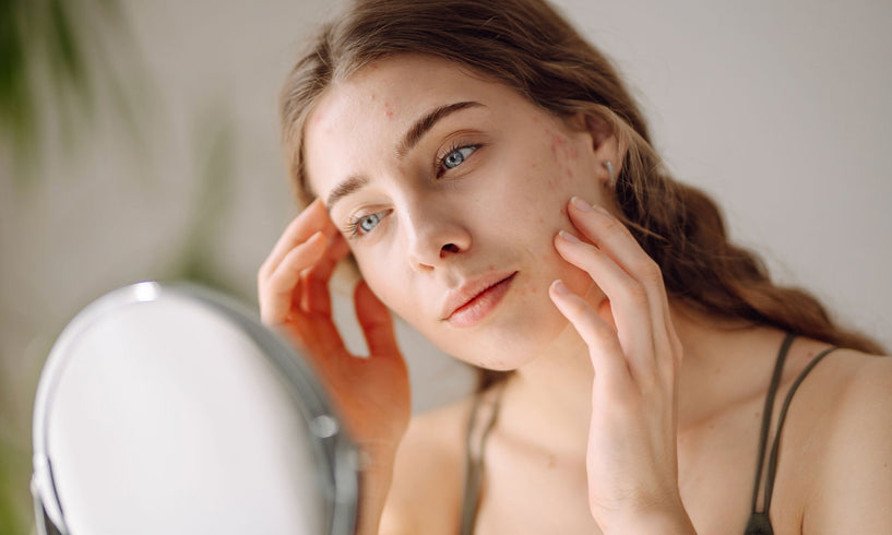 Essential guide to eczema skin care image